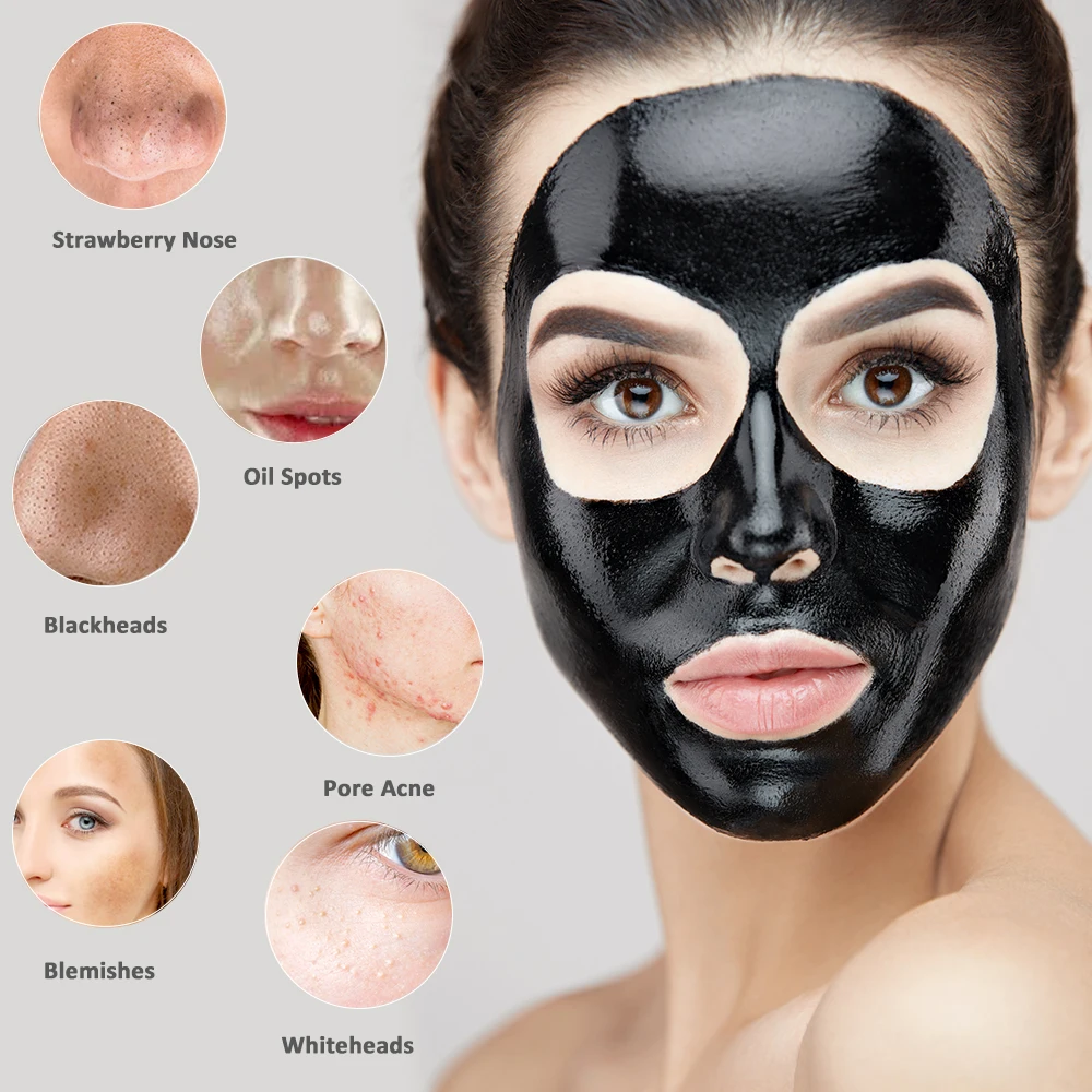Nos Črne Pike Masko Blackhead Krema za Odstranjevanje Pigmentacije Pege Odstranjevalec Masko Krema Kožo Brazgotin popravilo Mask