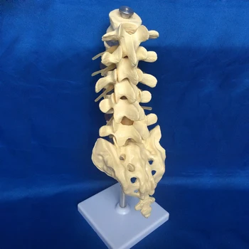 Ledvenih Model Hrbtenice Majhne Pet Ledvene Hrbtenice Model z Trojk Model Ledvenih Kosti Poškodbe Model za Poučevanje, Potrebščine