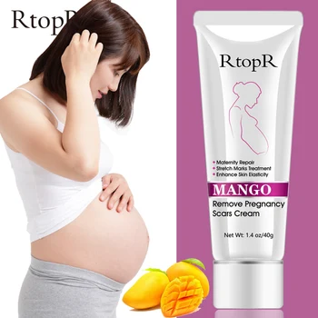 Mango Odstranite Nosečnosti Brazgotine Krema Za Popravilo Porodniškega Strij Debelosti Linije Krema Za Telo Anti-Winkles, Učvrstitev Kože, Za Nego